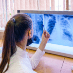 Nindanib-150mg Capsules-pharmaceutial-exporter-in-india-russia-philippines